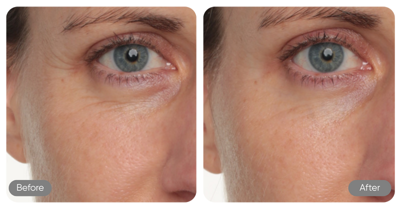 Before and after comparison