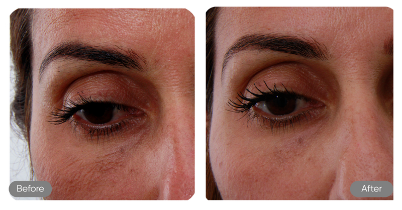 Before and after comparison