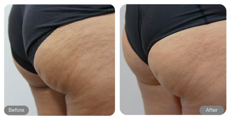 Before and after comparison