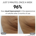 Sensifirm Anti-Cellulite Skin Toning