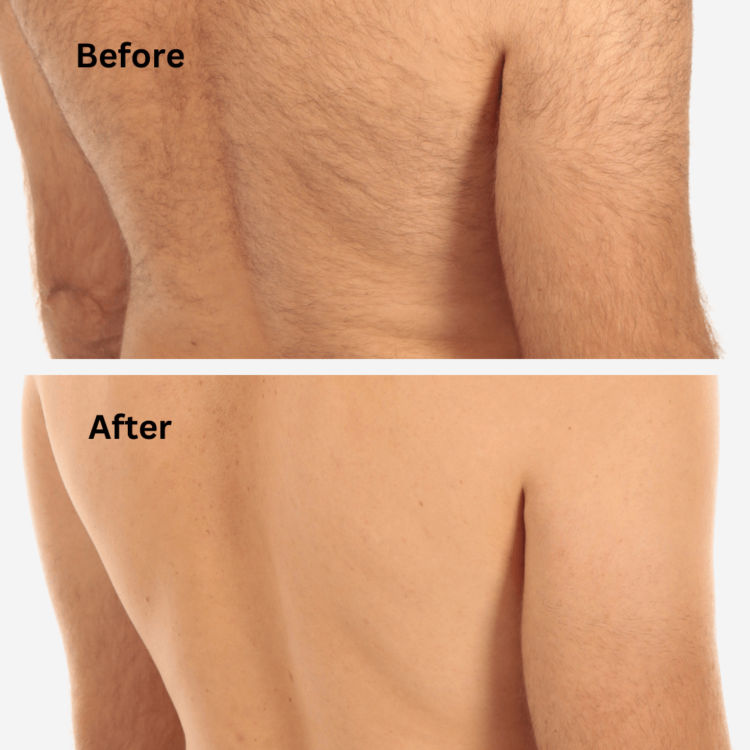 Before and After Back