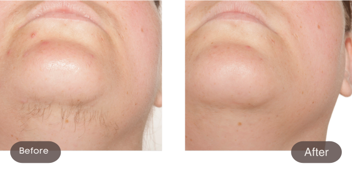 Before and after comparison