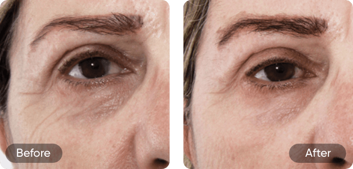 Before and after comparison