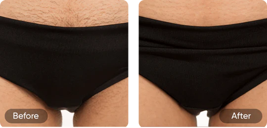 Before and after comparison