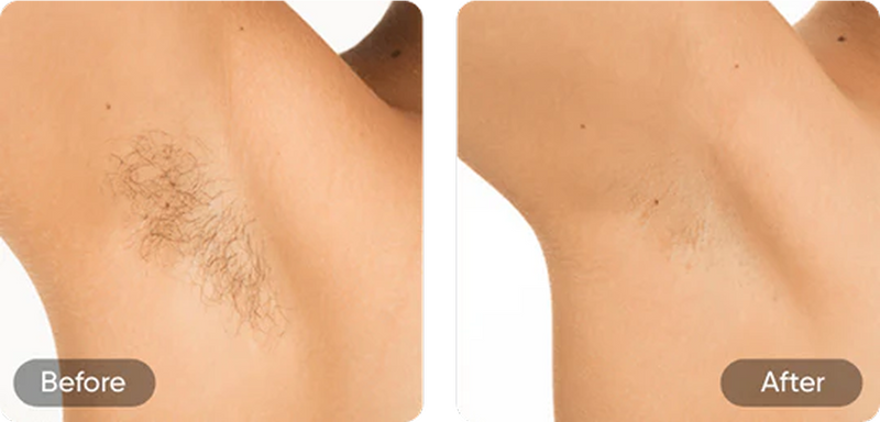 Before and after comparison